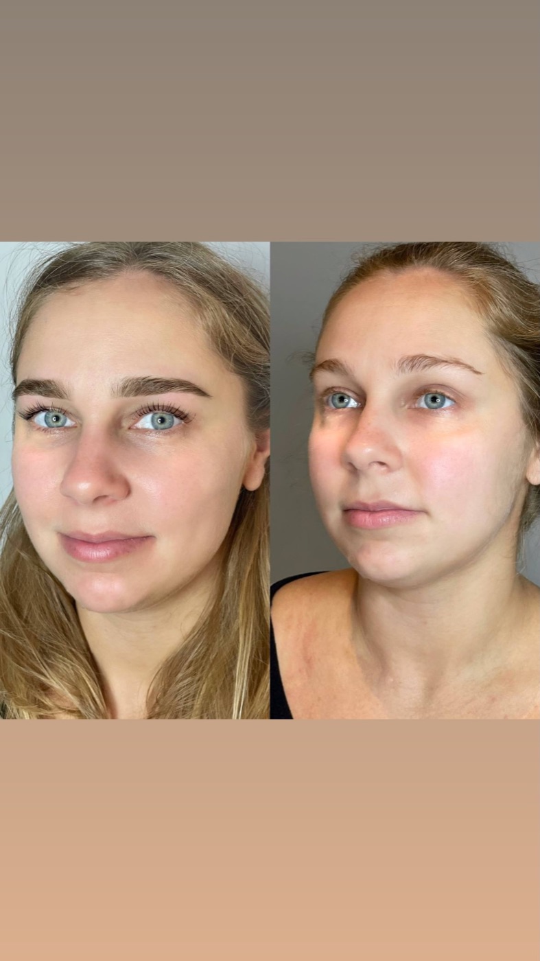 Ламинирование бровей и ресниц до и после — Beauty House Пхукет